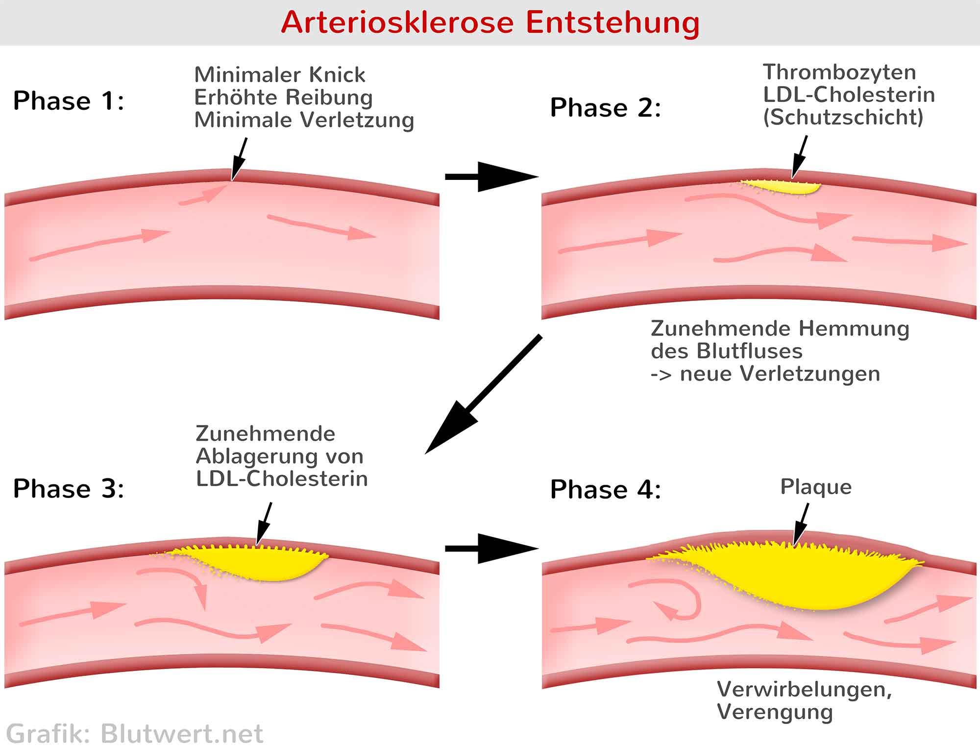 Cholesterin Lebenswichtig Wann Und Warum Gef hrlich 