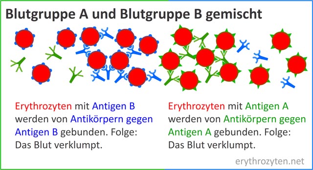 Hämagglutination - Verklumpung von Blut verschiedener Blutgruppen