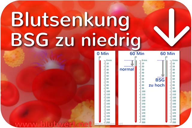 Blutwert BSG vermindert, zu niedrig