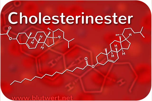Lipoproteine