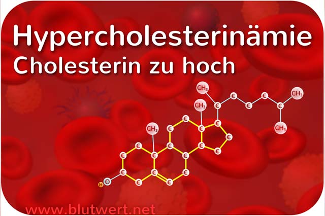 Hypercholesterinämie