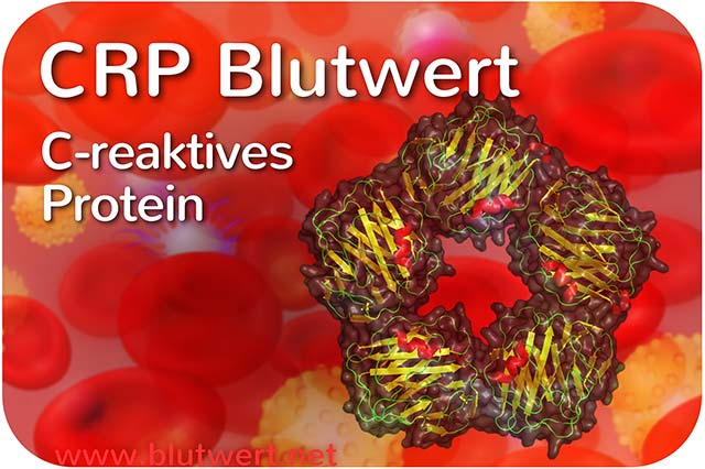 CRP (C-reaktives Protein)