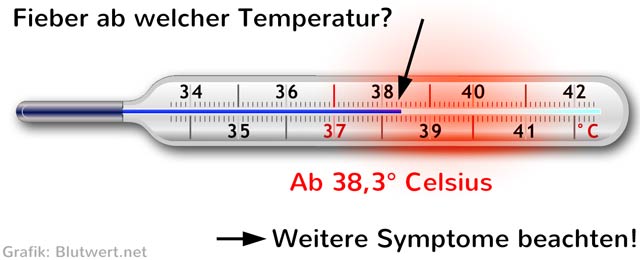 Ab wann hat man Fieber? Temperatur, Symptome