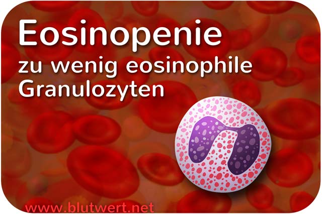 Zu wenig eosinophile Granulozyten, Blutwert zu niedrig: Eosinopenie