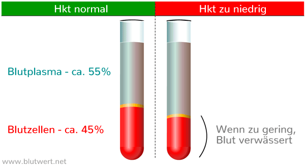 Hämatokrit zu niedrig: Verringerter Anteil von Blutzellen