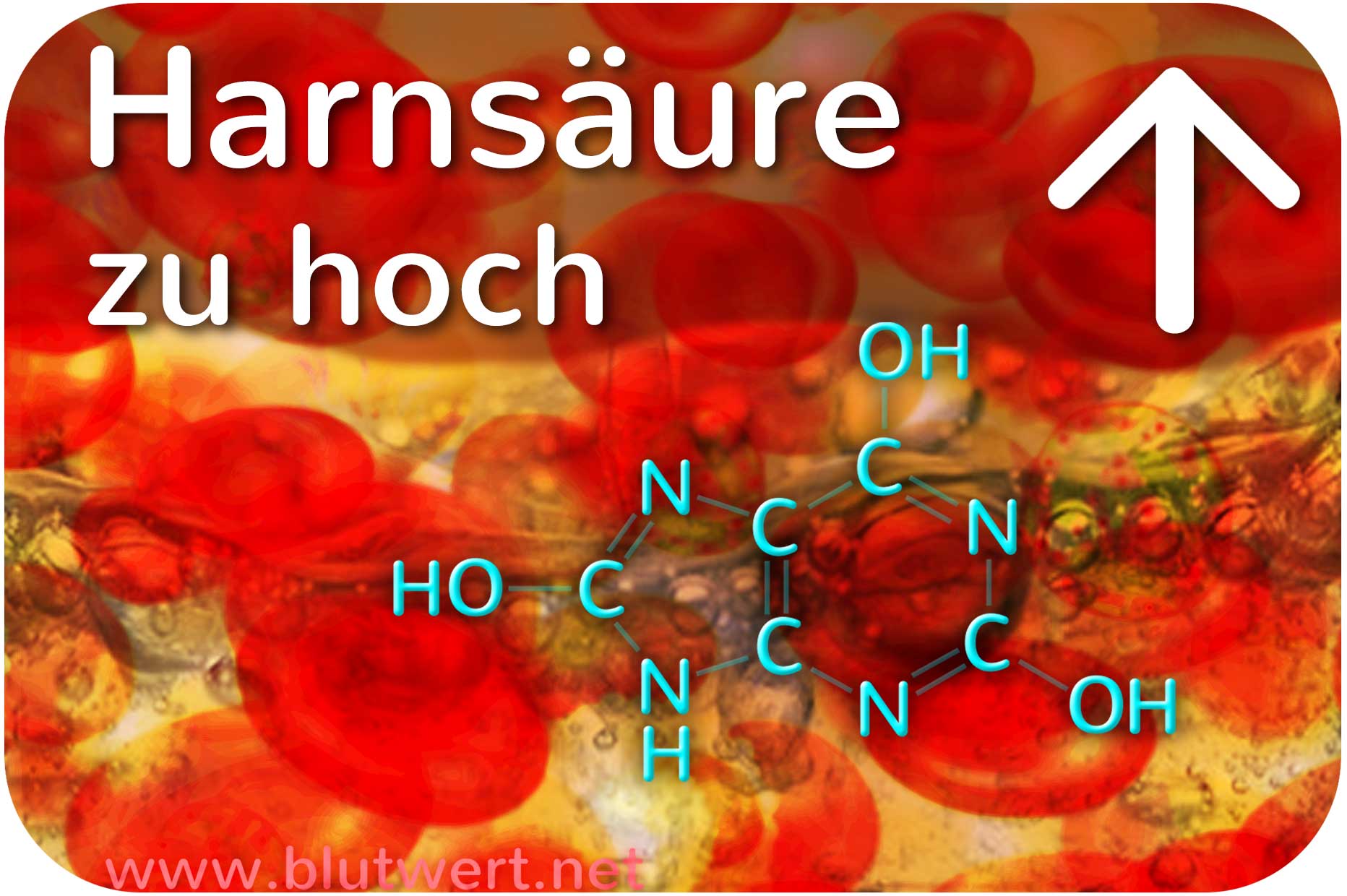 Harnsäure wert zu hoch