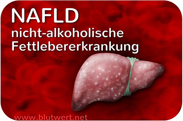 NAFLD: nicht-alkoholische Fettlebererkrankung