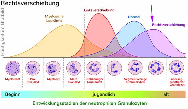Rechtsverschiebung