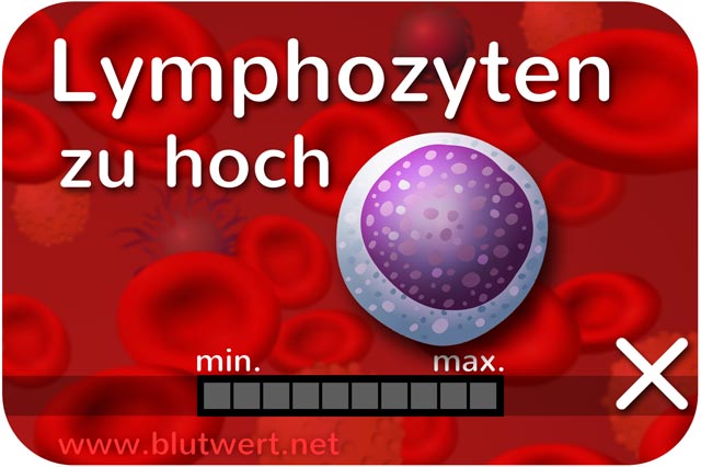 Zu viele Lymphozyten: Blutwert erhöht bzw. zu hoch