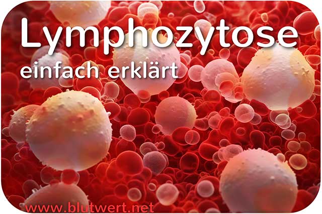 Lymphozytose: Zu viele Lymphozyten