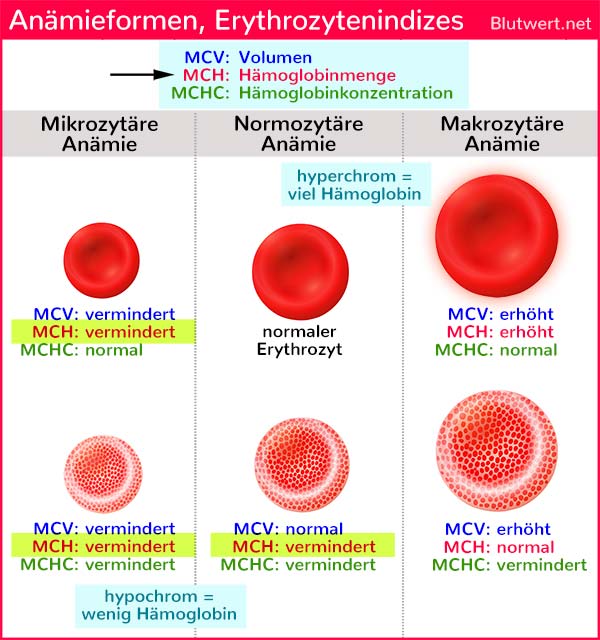 Blutwert MCH (Hämoglobinmenge pro Erythrozyt) zu niedrig