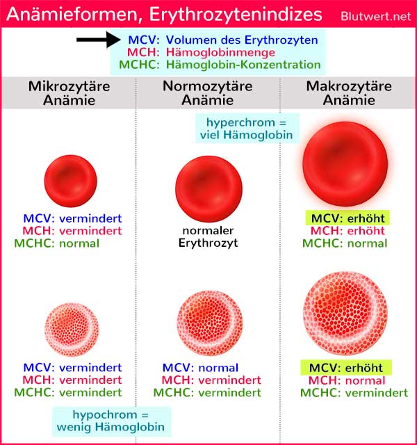 MCV-Wert vermindert, zu niedrig: rote Blutkörperchen zu klein