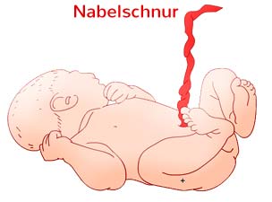Nabelschnur beim Neugeborenen
