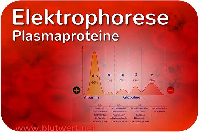 Elektrophorese: Trennung der Plasmaproteine