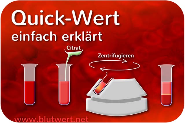 Quick-Wert einfach erklärt