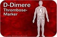 D-Dimere: Thrombose-Marken (Blutwert)