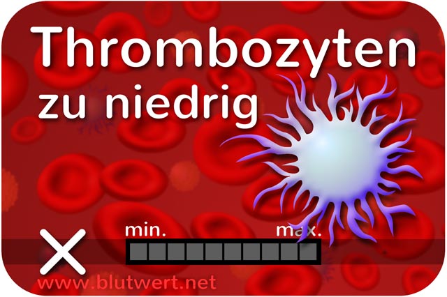 Thrombozyten zu niedrig (Blutwert Thrombo vermindert)