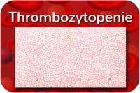 Thrombozytopenie